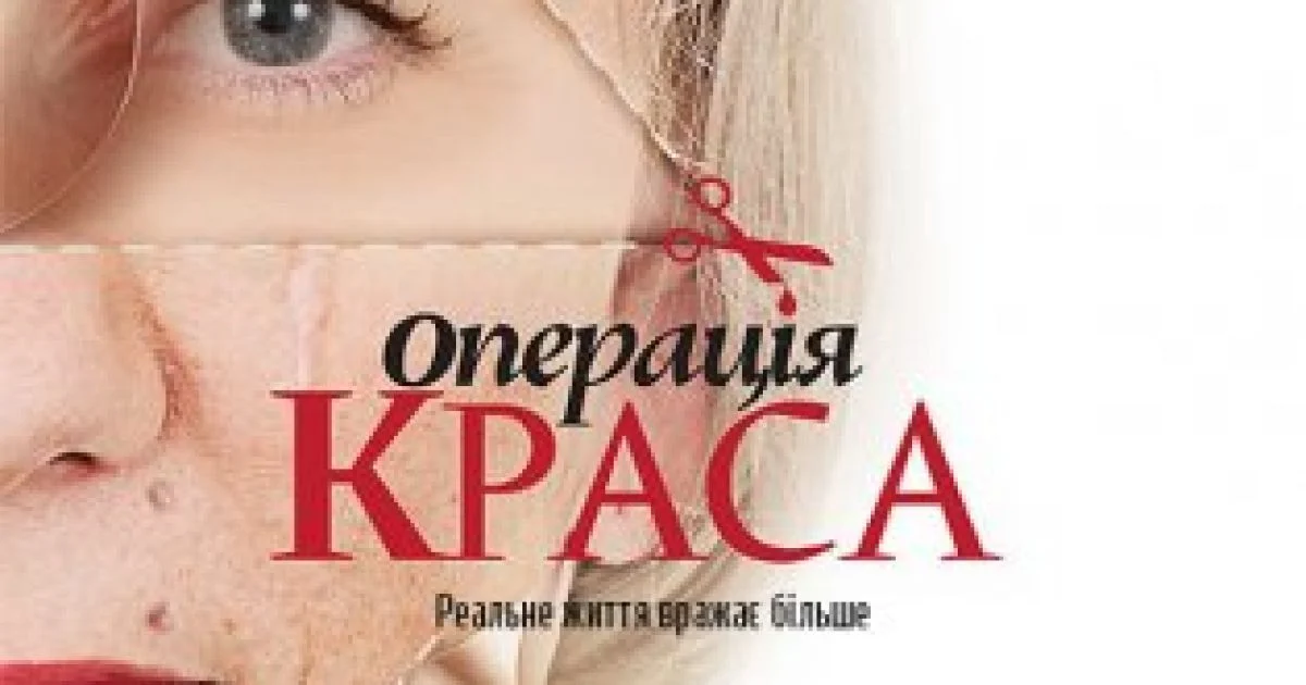 «Операция Красота»